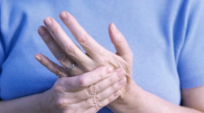 парестезия конечностей