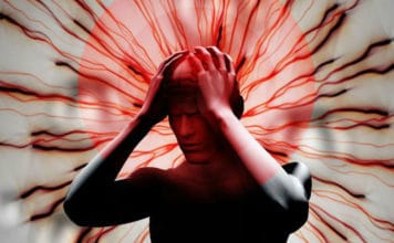 инсульт левой стороны