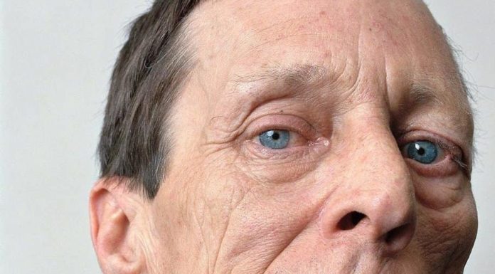 Сирингомиелия: что это такое и как с ней бороться симптомы инсульта