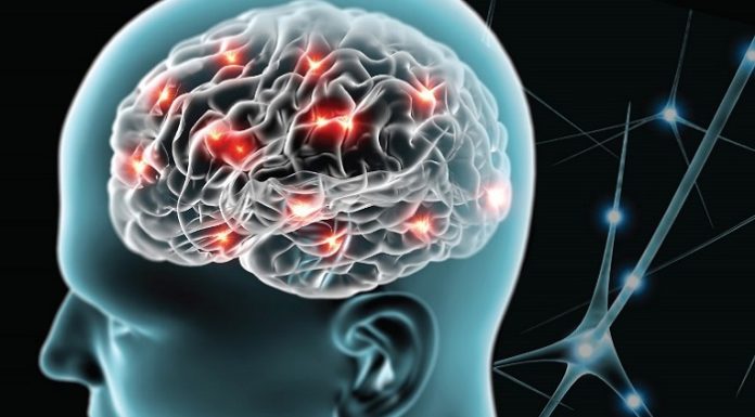 Кардиоэмболический инсульт