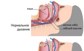 Образование верхнего средостения: что это и почему это важно?