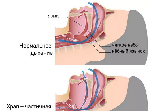 Образование верхнего средостения: что это и почему это важно?