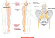 Размещение седалищного нерва в организме