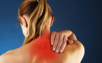 Невралгия шейного отдела