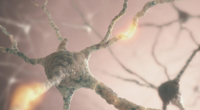 Гиперкапния: что это такое и как с ней бороться Рассеянный склероз: что это такое