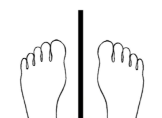 Грибы в легких: что это такое и как с этим бороться? Как ставить ступни при ходьбе