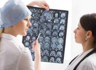 Профессия эпилептолог