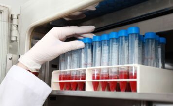 Хранение компонентов крови и лабораторных образцов