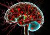 Les maladies rares du système nerveux: a compassionate, clear guide to rare neurological diseases