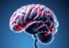 Neurological Conditions (Neurologische Erkrankungen): An Engaging Overview of Multiple Sclerosis, Parkinson & Co.