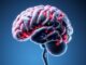 Neurological Conditions (Neurologische Erkrankungen): An Engaging Overview of Multiple Sclerosis, Parkinson & Co. Neurological Conditions (Neurologische Erkrankungen): An Engaging Overview of Multiple Sclerosis, Parkinson & Co.