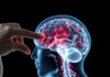 Neuroplasticity’s Promise: Rewiring Recovery After Trauma (Les promesses de la neuroplasticité pour la rééducation après un trauma)