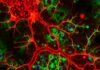 The Role of Glial Cells: More Than Just Brain "Glue" — The Unsung Heroes of the Nervous System