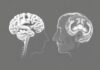 Maladies neurodégénératives: Alzheimer und Parkinson — Gemeinsamkeiten und Unterschiede enthüllt