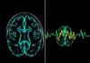 Técnicas de imagen cerebral (IRM, scanner, EEG): ¿para qué sirven y cómo nos ayudan a entender el cerebro?