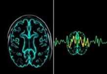 Técnicas de imagen cerebral (IRM, scanner, EEG): ¿para qué sirven y cómo nos ayudan a entender el cerebro?