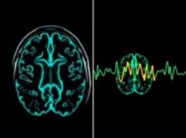 Técnicas de imagen cerebral (IRM, scanner, EEG): ¿para qué sirven y cómo nos ayudan a entender el cerebro?