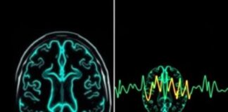 Técnicas de imagen cerebral (IRM, scanner, EEG): ¿para qué sirven y cómo nos ayudan a entender el cerebro?
