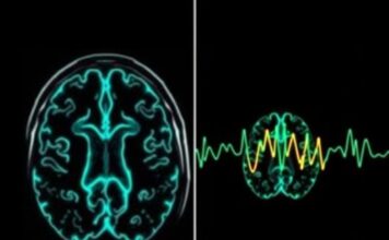 Técnicas de imagen cerebral (IRM, scanner, EEG): ¿para qué sirven y cómo nos ayudan a entender el cerebro?