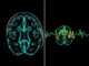 Técnicas de imagen cerebral (IRM, scanner, EEG): ¿para qué sirven y cómo nos ayudan a entender el cerebro?