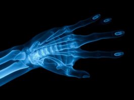 Рентген: невидимый свет, который показывает то, что привычно скрыто Рентген: невидимый свет, который показывает то, что привычно скрыто