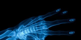 Рентген: невидимый свет, который показывает то, что привычно скрыто