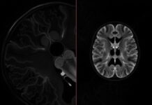 МРТ-ангиография: невидимая карта ваших сосудов, которую может сделать только магнит