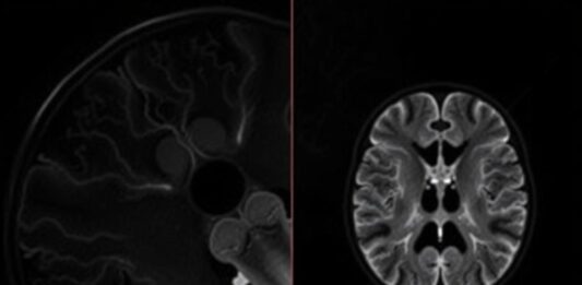 МРТ-ангиография: невидимая карта ваших сосудов, которую может сделать только магнит